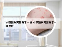 小孩额头突然白了一块 小孩额头突然白了一块发红