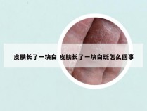 皮肤长了一块白 皮肤长了一块白斑怎么回事