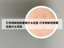 打生物制剂前要做什么检查 打生物制剂需要检查什么项目