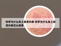 秋季为什么身上容易长癣 秋季为什么身上容易长癣怎么回事