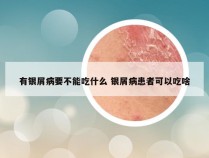 有银屑病要不能吃什么 银屑病患者可以吃啥