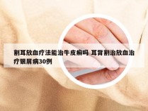 割耳放血疗法能治牛皮癣吗 耳背割治放血治疗银屑病30例