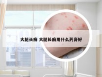 大腿长癣 大腿长癣用什么药膏好