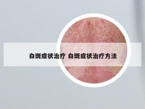 白斑症状治疗 白斑症状治疗方法