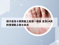 孩子出生十四天脸上出现一块白 出生14天的宝宝脸上有小白点