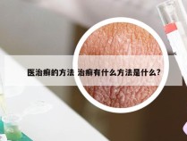 医治癣的方法 治癣有什么方法是什么?