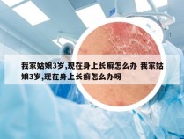 我家姑娘3岁,现在身上长癣怎么办 我家姑娘3岁,现在身上长癣怎么办呀