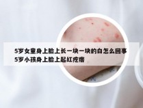 5岁女童身上脸上长一块一块的白怎么回事 5岁小孩身上脸上起红疙瘩