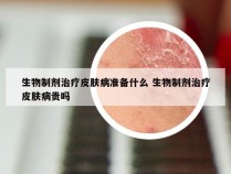 生物制剂治疗皮肤病准备什么 生物制剂治疗皮肤病贵吗