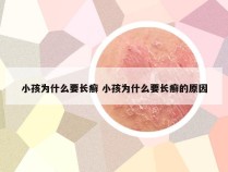 小孩为什么要长癣 小孩为什么要长癣的原因