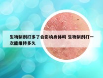 生物制剂打多了会影响身体吗 生物制剂打一次能维持多久