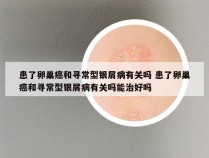 患了卵巢癌和寻常型银屑病有关吗 患了卵巢癌和寻常型银屑病有关吗能治好吗