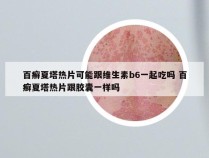 百癣夏塔热片可能跟维生素b6一起吃吗 百癣夏塔热片跟胶囊一样吗