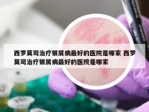 西罗莫司治疗银屑病最好的医院是哪家 西罗莫司治疗银屑病最好的医院是哪家