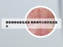 银屑病用啥香皂洗澡 银屑病可以用药皂洗澡么