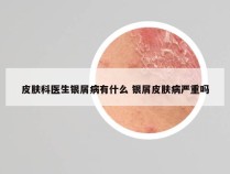 皮肤科医生银屑病有什么 银屑皮肤病严重吗