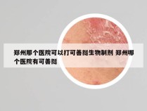 郑州那个医院可以打可善挺生物制剂 郑州哪个医院有可善挺