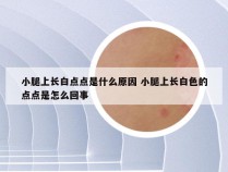 小腿上长白点点是什么原因 小腿上长白色的点点是怎么回事