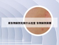 用生物制剂先做什么检查 生物制剂需要