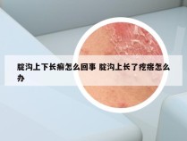 腚沟上下长癣怎么回事 腚沟上长了疙瘩怎么办