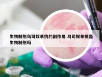 生物制剂乌司奴单抗的副作用 乌司奴单抗是生物制剂吗