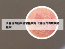 长春治白颠风哪家医院好 长春治疗白斑病的医院