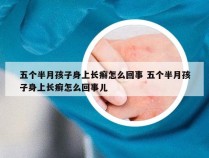 五个半月孩子身上长癣怎么回事 五个半月孩子身上长癣怎么回事儿