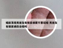 婚前发现男朋友有银屑病要不要结婚 男朋友有银屑病你会嫁吗