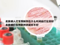 皮肤病人打生物制剂在什么时间段打比较好 皮肤病打生物制剂到底好不好