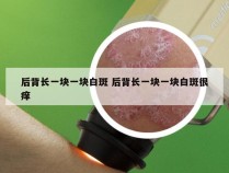 后背长一块一块白斑 后背长一块一块白斑很痒