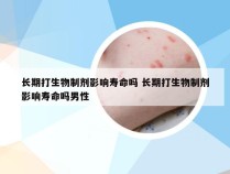 长期打生物制剂影响寿命吗 长期打生物制剂影响寿命吗男性