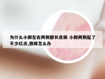 为什么小脚左右两侧都长皮癣 小脚两侧起了不少红点,很痒怎么办