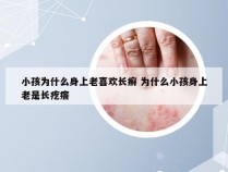 小孩为什么身上老喜欢长癣 为什么小孩身上老是长疙瘩