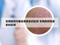 生物制剂与糖皮质激素的区别 生物制剂和激素的区别