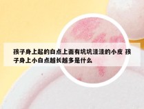 孩子身上起的白点上面有坑坑洼洼的小皮 孩子身上小白点越长越多是什么