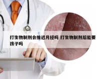 打生物制剂会推迟月经吗 打生物制剂后能要孩子吗