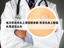 每次剪完头头上发现很多癣 剪完头身上都是头发渣怎么办