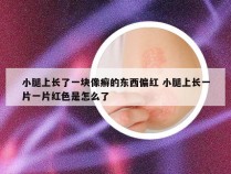 小腿上长了一块像癣的东西偏红 小腿上长一片一片红色是怎么了