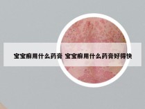 宝宝癣用什么药膏 宝宝癣用什么药膏好得快