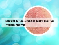 腿关节处有个癣一样的东西 腿关节处有个癣一样的东西是什么