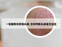 一张图教你辨别头癣 怎样判断头癣是否痊愈