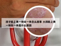 孩子脸上黄一块白一块怎么回事 小孩脸上黄一块白一块是什么原因