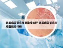 银屑病关节炎哪里治疗的好 银屑病关节炎治疗医院排行榜