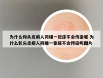 为什么和头皮癣人同睡一张床不会传染呢 为什么和头皮癣人同睡一张床不会传染呢图片