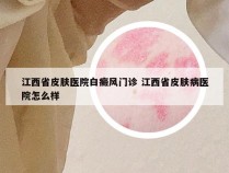 江西省皮肤医院白癜风门诊 江西省皮肤病医院怎么样