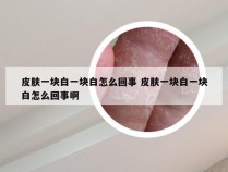 皮肤一块白一块白怎么回事 皮肤一块白一块白怎么回事啊