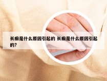 长癣是什么原因引起的 长癣是什么原因引起的?