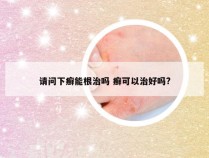 请问下癣能根治吗 癣可以治好吗?