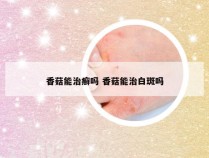 香菇能治癣吗 香菇能治白斑吗