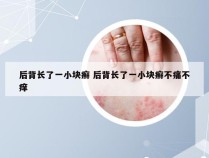 后背长了一小块癣 后背长了一小块癣不痛不痒